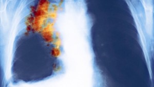 никотин в легких