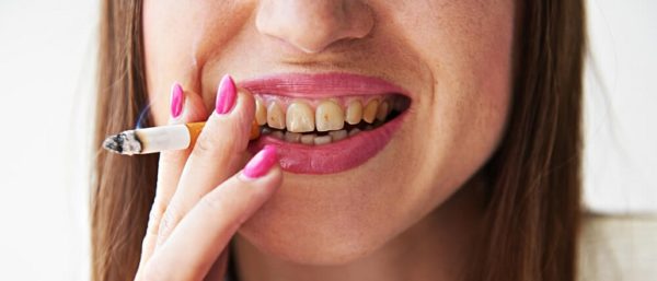 Kak ochistit zubi ot nikotina v domashnih usloviyah