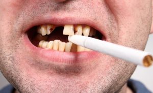 ischeznovenie problem s zubami